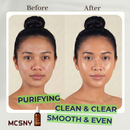 MCSNY PhytoVita Purifying Serum